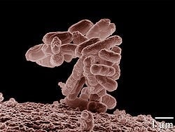 Goede bacteriën in de darm: het microbioom. 