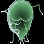 Lamblia Intestinalis
