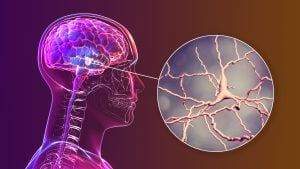 Substantia Nigra bij Parkinson
