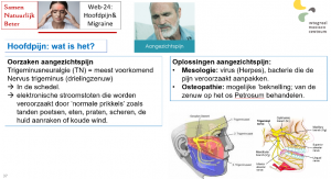 Webinar over hoofdpijn & Migraine (incl. trigeminusneuralgie)