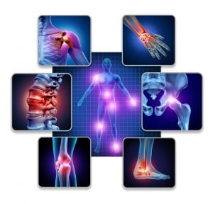 artritis